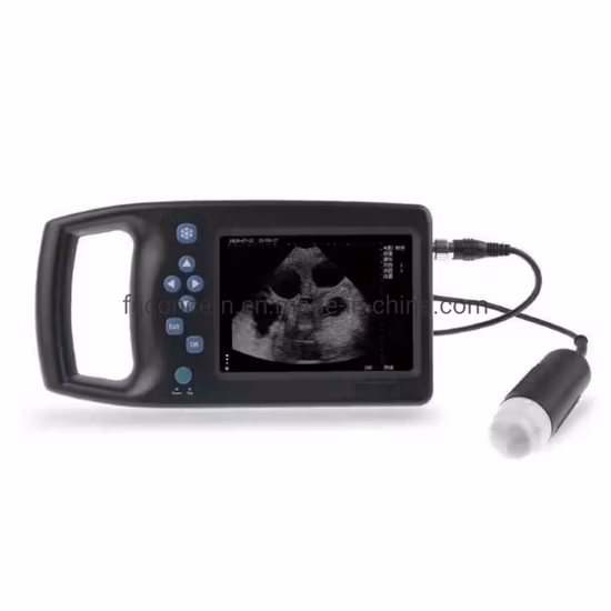 Paramètres fonctionnels les moins chers Analyse du ventilateur mécanique Prix de l'instrument de diagnostic à ultrasons